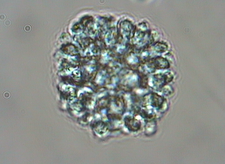 Dictyocha speculum